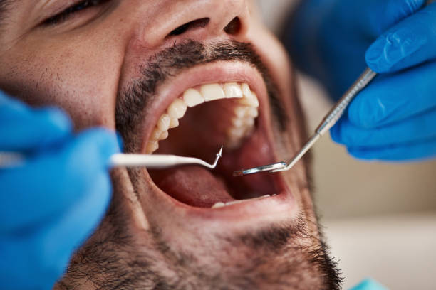 Best After-Hours Emergency Dentist in Granite Quarry, NC